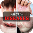 プログラムのアイコン：All Skin Diseases  Treatm…