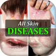 All Skin Diseases  Treatment