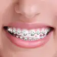 Fake Braces Camera with Photo Stickers for Teeth
