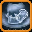 أيقونة البرنامج: Ultrasound Spoof 2016: Pr…
