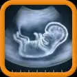Ultrasound Spoof 2016: Pregnancy Test