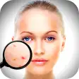 Face Enhancer - Photo Face Blemishes Remover