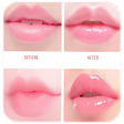 Ikona programu: Natural Pink Lips Remedie…