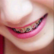 プログラムのアイコン：Braces