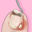 程序图标：Pedicure Master