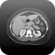 程序图标：Radiology CT Viewer