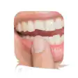 Broken Tooth no Pain Guide