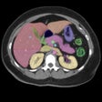 Ikon program: Anatomy on Radiology CT