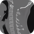 プログラムのアイコン：CT Cervical Spine