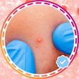 رمز البرنامج: Image Remove Acne