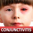 Иконка программы: Conjunctivitis & Pinkeye …
