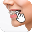 程序图标：Braces on teeth: Photo ed…
