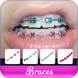 Ikona programu: Braces Colors Beauty