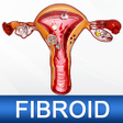 Ikona programu: Uterine Fibroid Treatment…