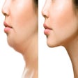 プログラムのアイコン：How To Lose Face Fat