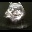 程序图标: Full Term - Contraction T…