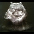 Ikona programu: Full Term - Contraction T…