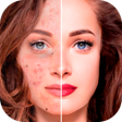 Ícone do programa: Blemishes Removal