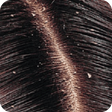 程序图标：How to Rid Of Dandruff