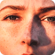 Icon of program: Get Rid Dark Spot On Skin