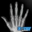 X-Ray Scanner